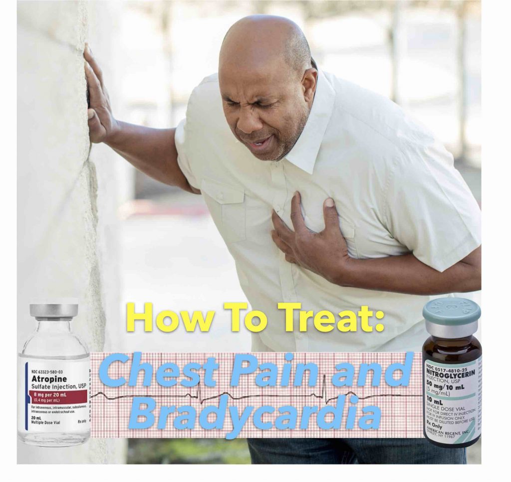Chest Pain and Bradycardia