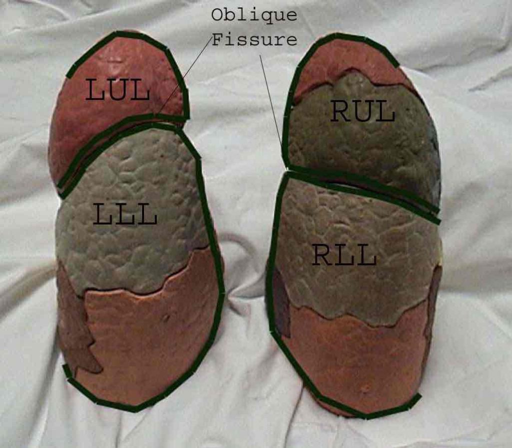 Lung Lobes Posterior View