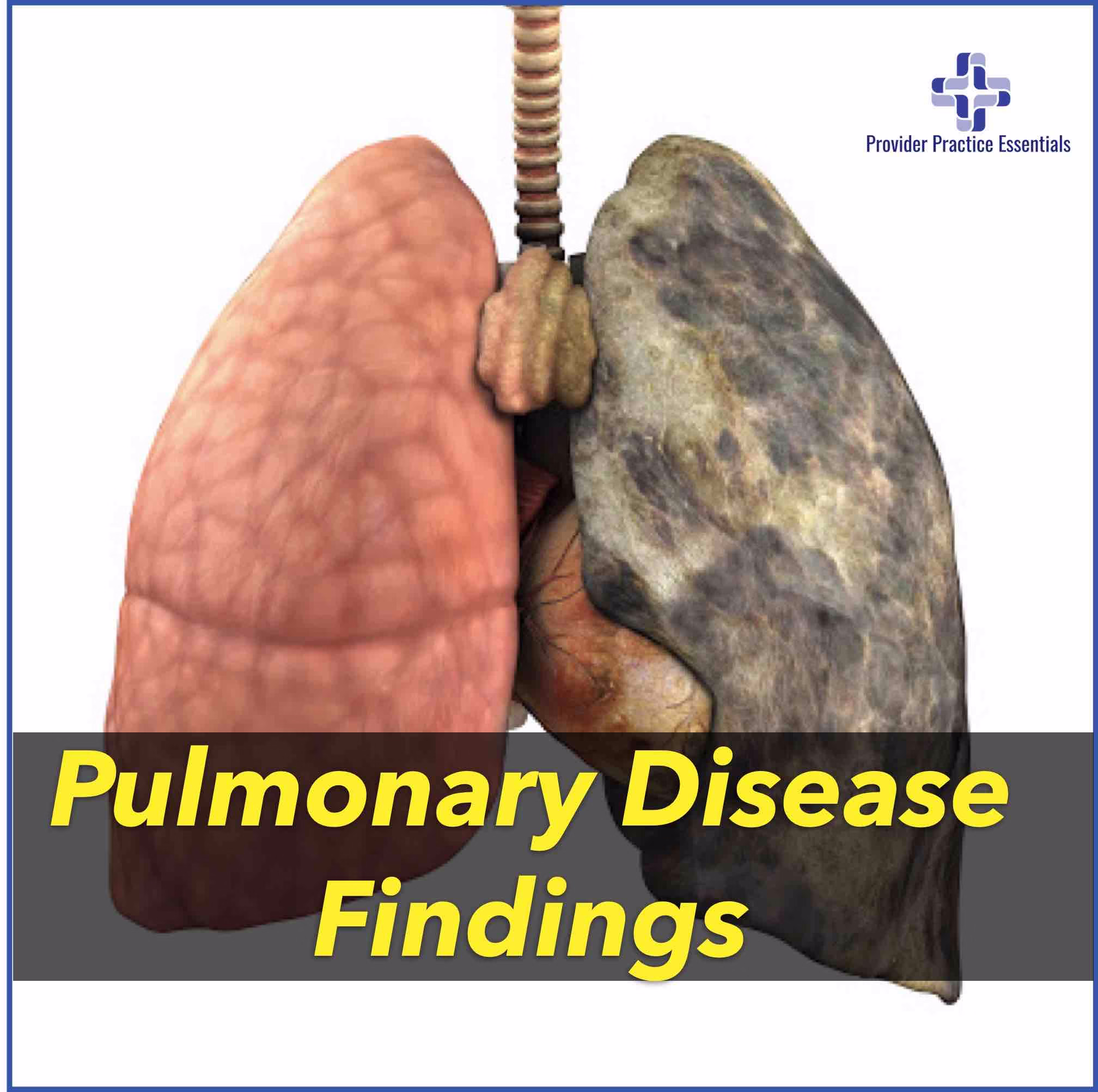 Pulmonary disease findings