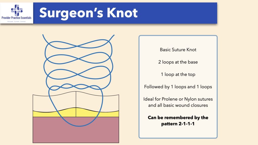 Surgeon's Knot
