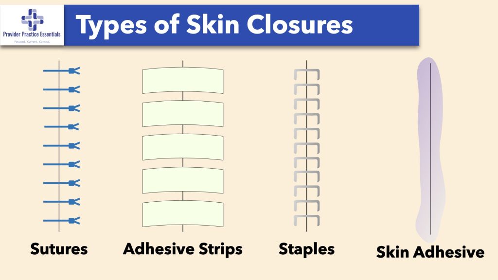 Types of Skin Closures
