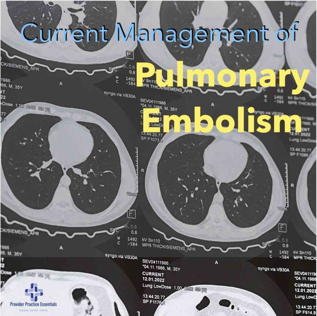 Current management of pulmonary embolism